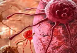 Photo of सिर्फ बुजुर्ग नहीं, अब युवाओं को भी शिकार बना रहा है कैंसर