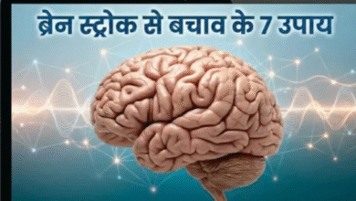 Photo of ब्रेन स्ट्रोक का खतरा टाल सकती हैं आपकी ये 7 आदतें