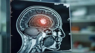 Photo of शरीर की ‘शुगर’ का इस्तेमाल करेक ताकतवर बन रहा ब्रेन ट्यूमर