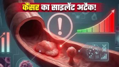 Photo of आंतों में इन दो तरह की गांठ से 5 गुना तक बढ़ जाता है कैंसर का खतरा
